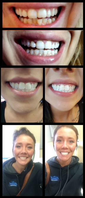 teethweb teethweb